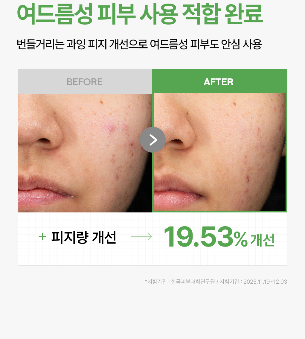 메디힐 더마365 2세대 티트리 6