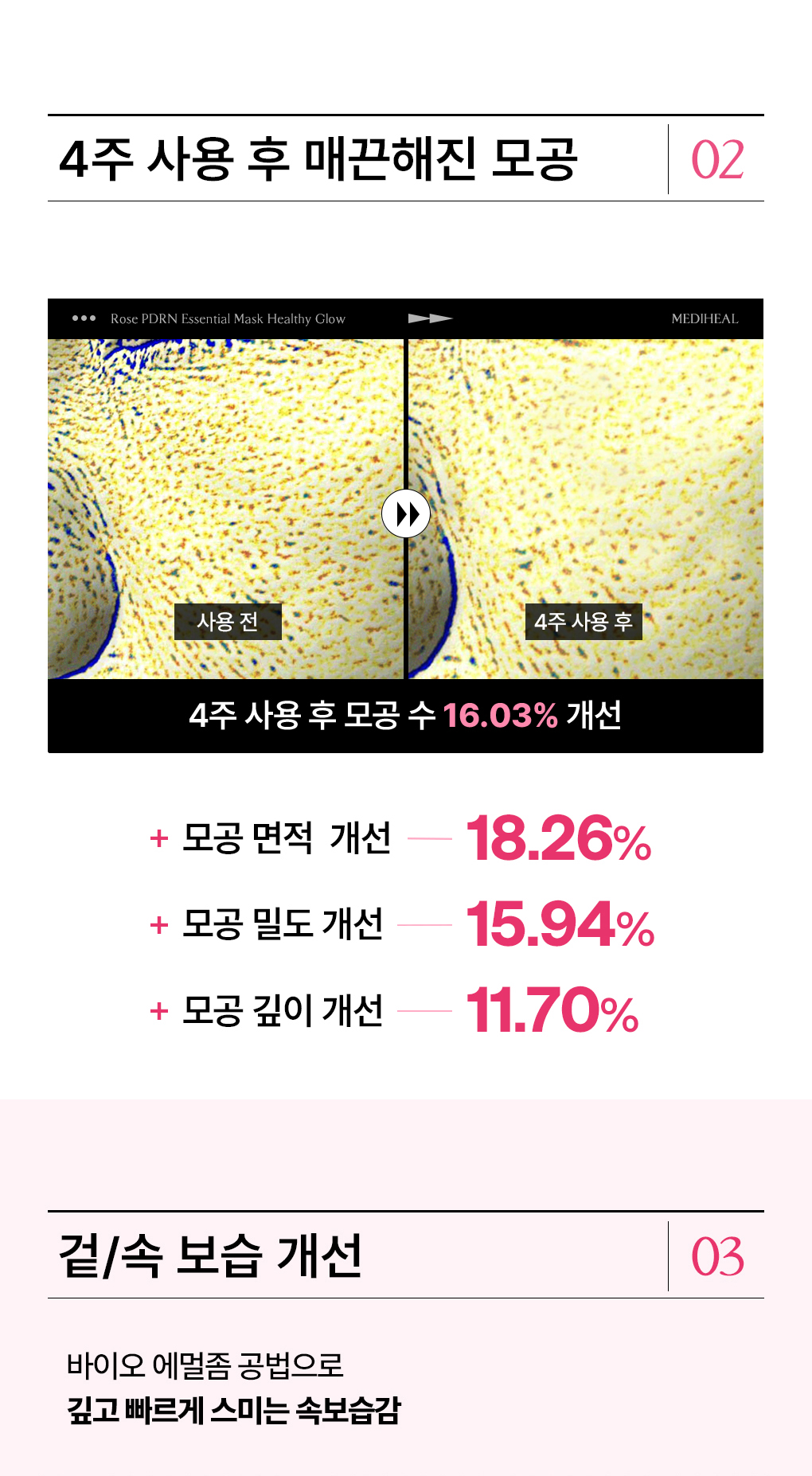 메디힐 에센셜 마스크 12