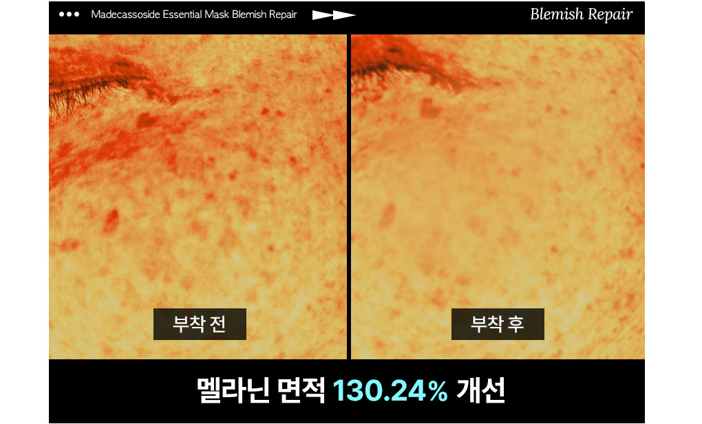 메디힐 에센셜 마스크 16