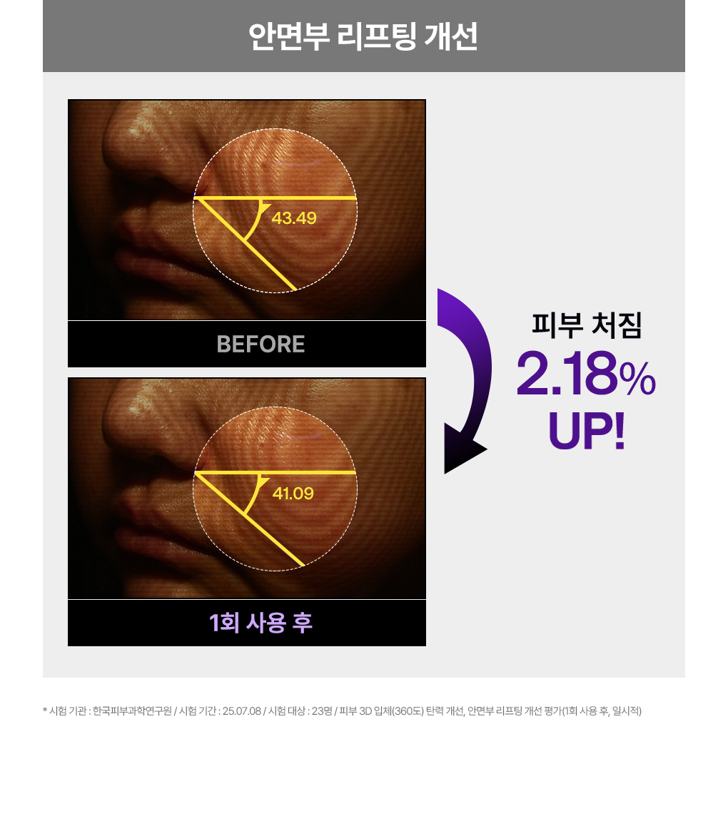 메디힐 랩핑 세럼 마스크 PDRN 15