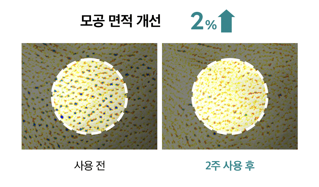 마데카소사이드 모공 리페어 세럼