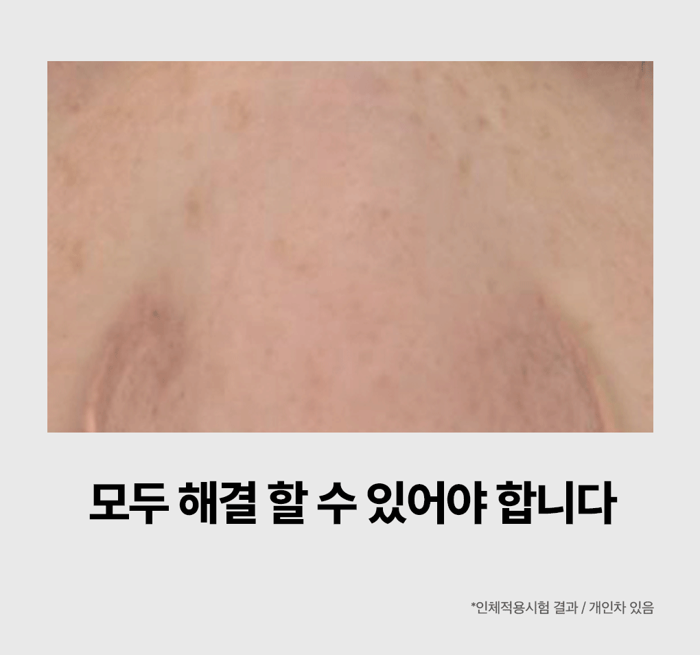 마데카소사이드 모공 리페어 세럼