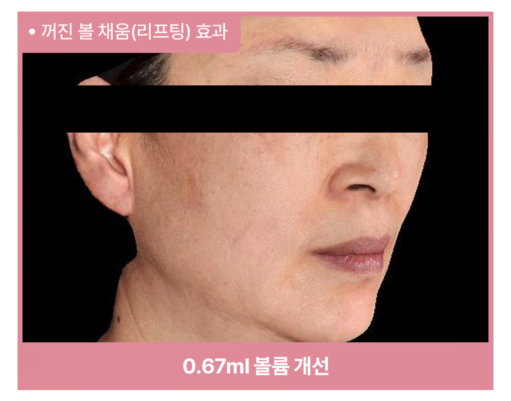 메디힐 하이퍼 마스크 콜라겐 10