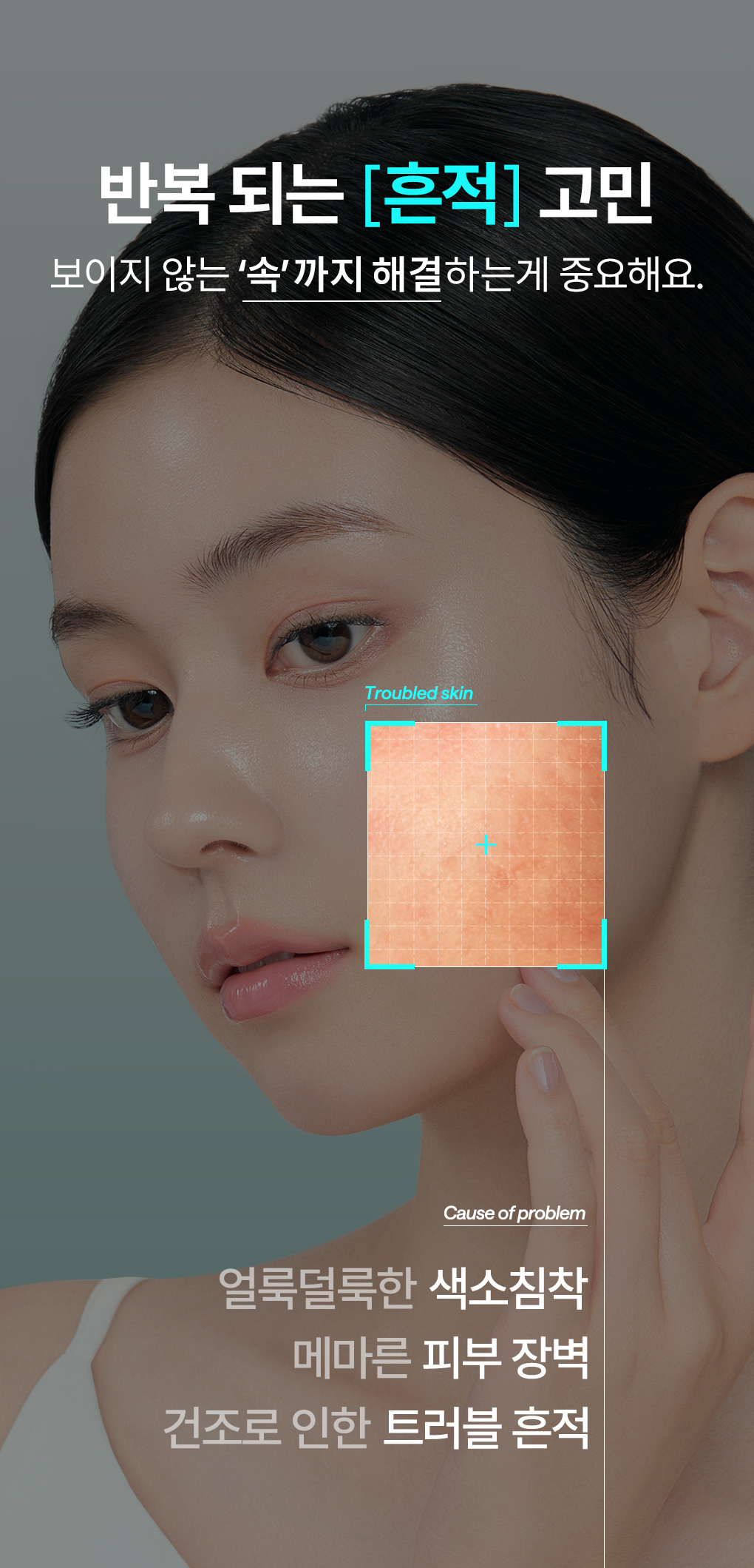 메디힐 마데카소사이드 더마 크림 2