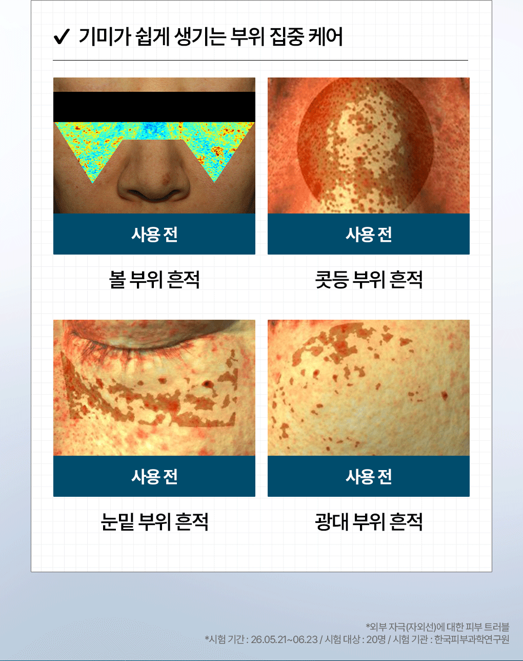 메디힐 더마세럼 마데카소사이드 8