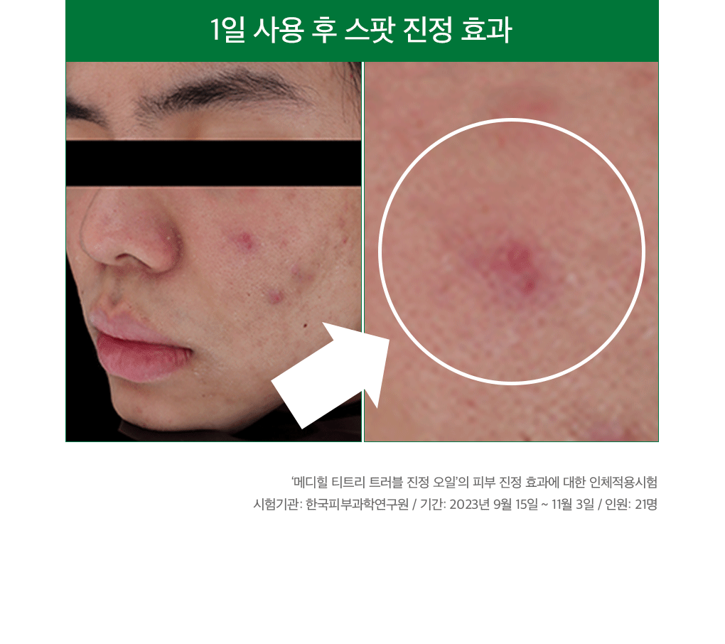 메디힐 티트리 트러블 진정 오일 8