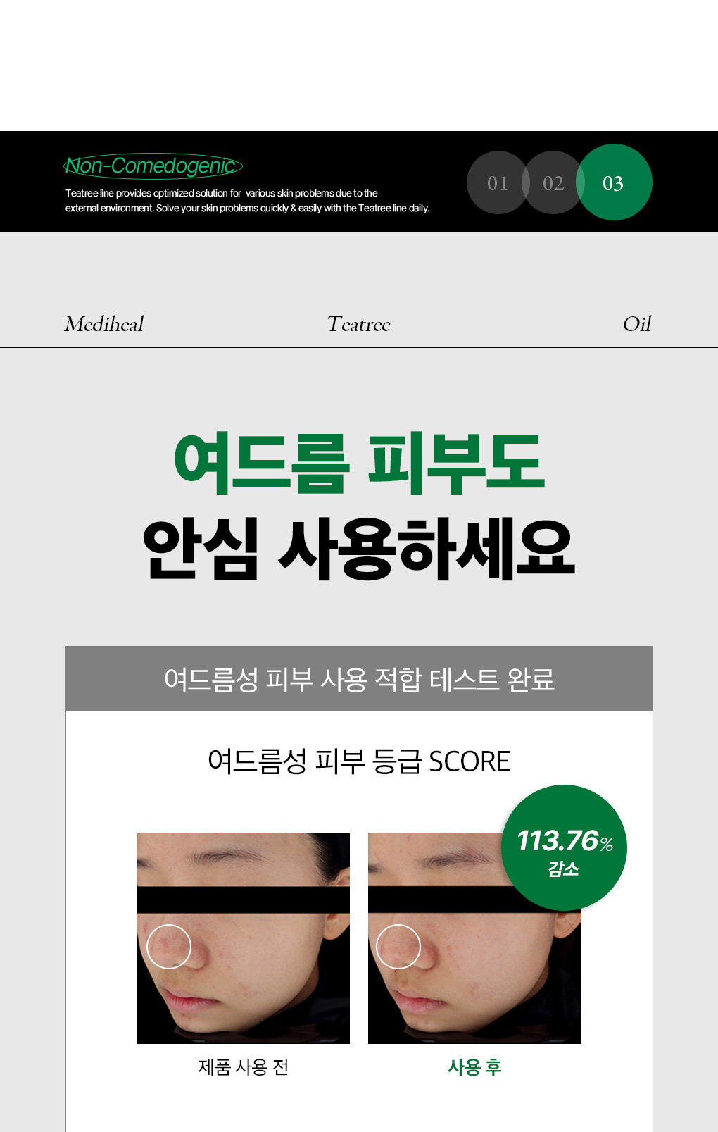 메디힐 티트리 트러블 진정 오일 11