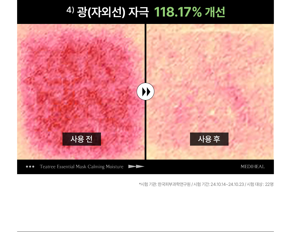 메디힐 티트리  14