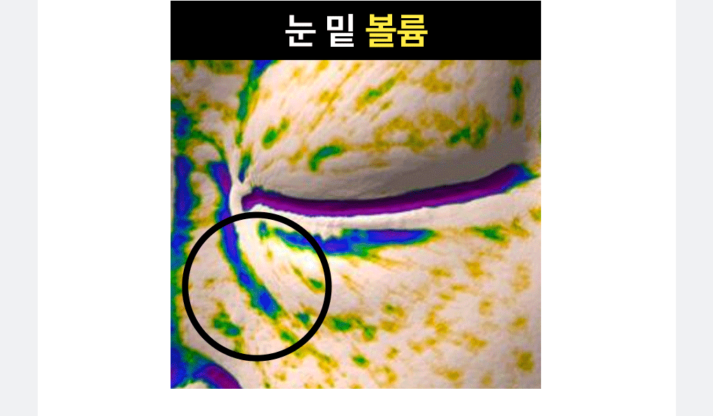 Vita Eye Patch 32