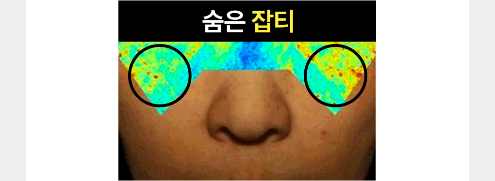 Vita Eye Patch 29